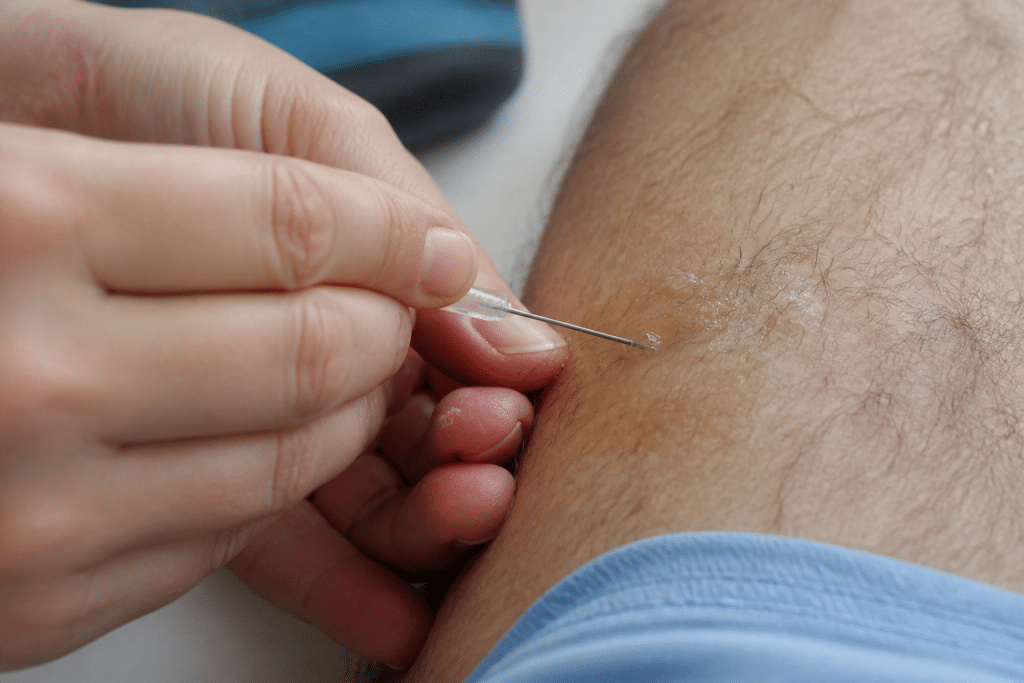 Main sterile needle piercing blister edge carefully with antiseptic